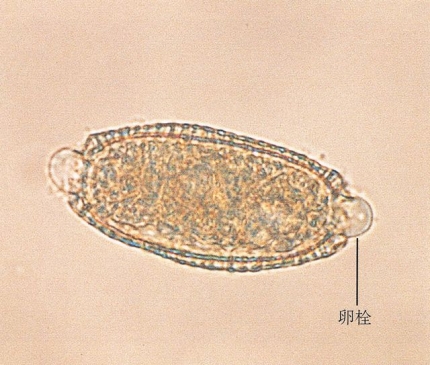 膀胱毛細線虫