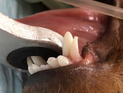 4本乳歯遺残 (4)