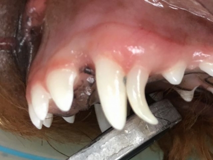 4本乳歯遺残 (3)